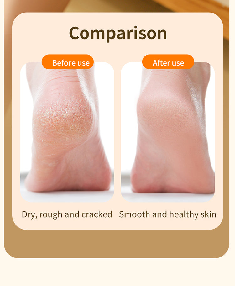 BNMQ callus remover gift packaging | Emballage cadeau du dissolvant de callosités BNMQ